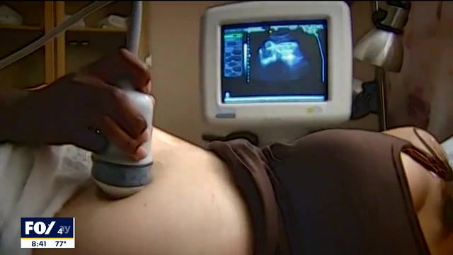 Anti-abortion group helps women with pregnancies