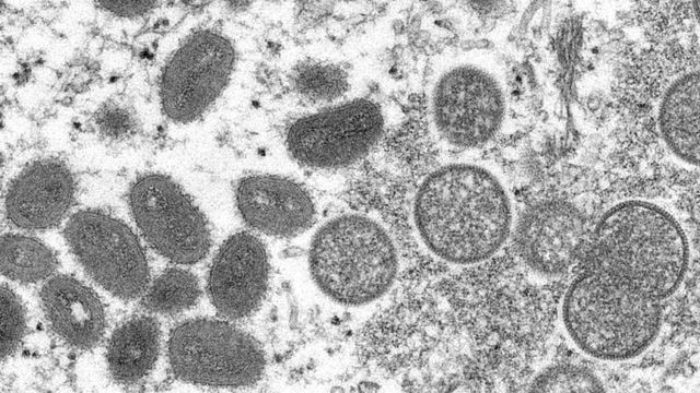 WHO warns of 'extraordinary' monkeypox outbreak