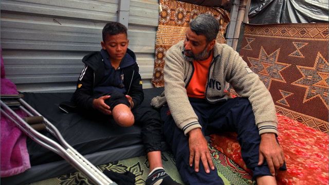Unprecedented number of child amputees in Gaza