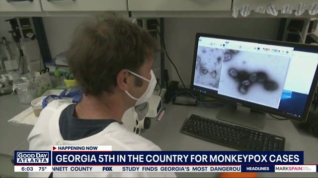 Georgia faces rising monkeypox cases, few vaccines