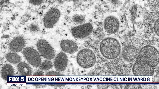 D.C. launches third monkeypox vaccine clinic