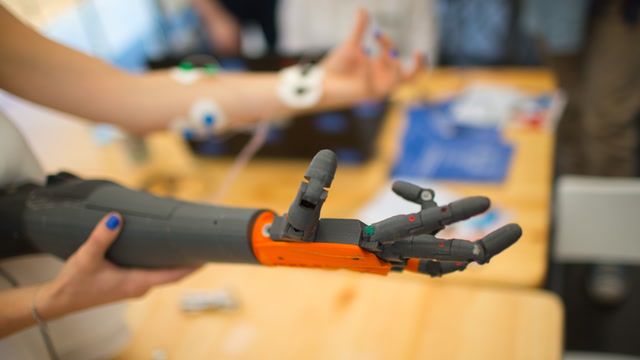 How prosthetics are adding temperature to touch